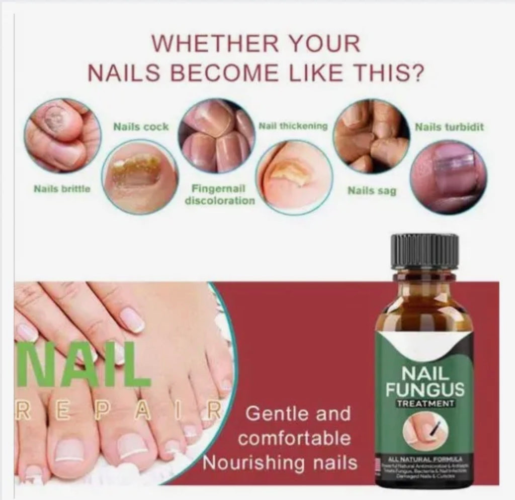Fast Nail Fungus Treatment Serum